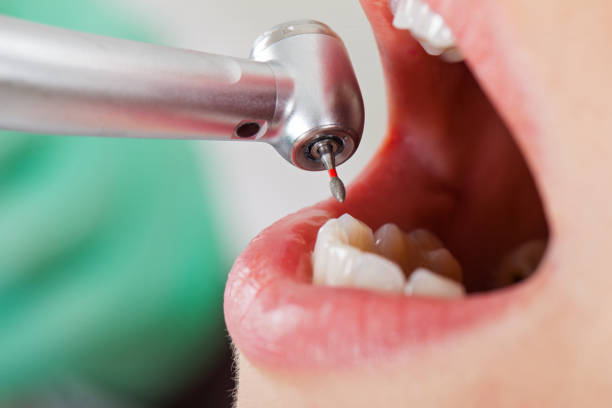 Best Emergency Dental Services for Seniors in Woodlawn Beach, FL